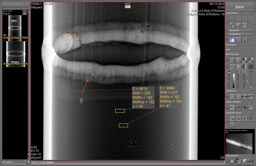 ORinspect-acquisition-and-evaluation-software-for-radiographic-testing-NDT-4